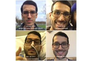 Transplant tips