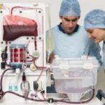 Machine perfusion