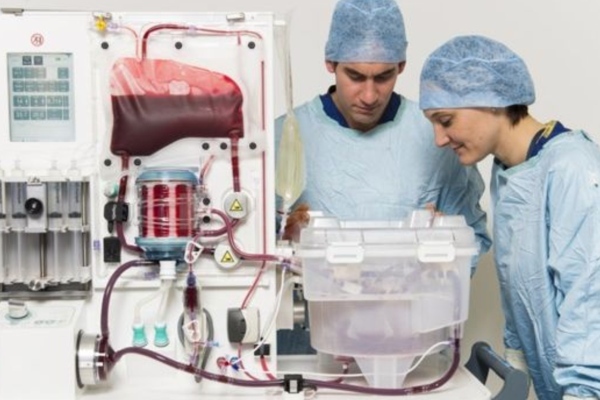 Machine perfusion