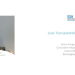 Liver Transplantation for PSC Video Dr James Ferguson