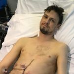 Nathan after transplant