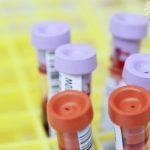 Blood test ALP ELF