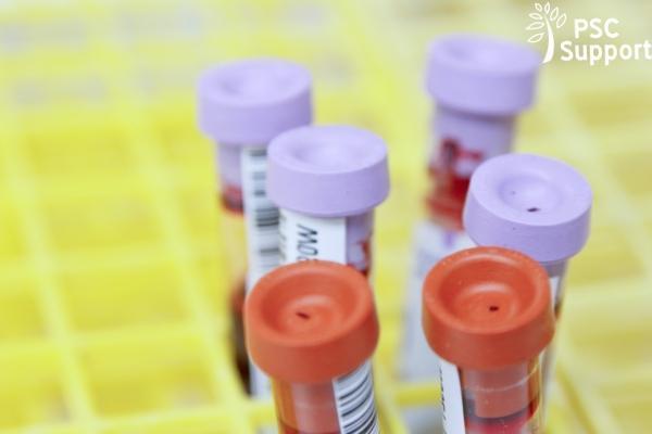 Blood test ALP ELF