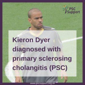 Kieron Dyer