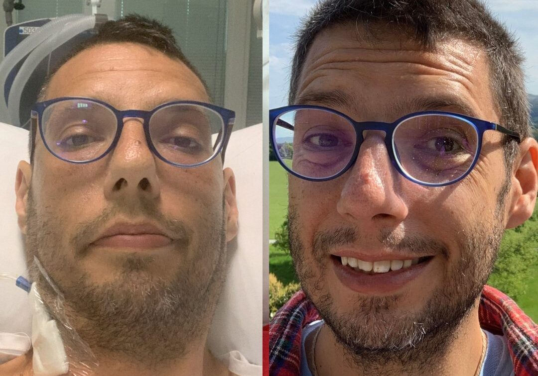 Two photos side by side of a white male with brown hair, left image he's in a hospital bed frowning, right image he's outside with a blue sky smiling