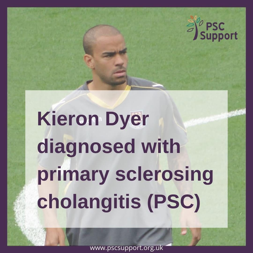 Kieron Dyer