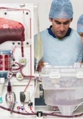 Machine_perfusion_PSC_Support Machine perfusion